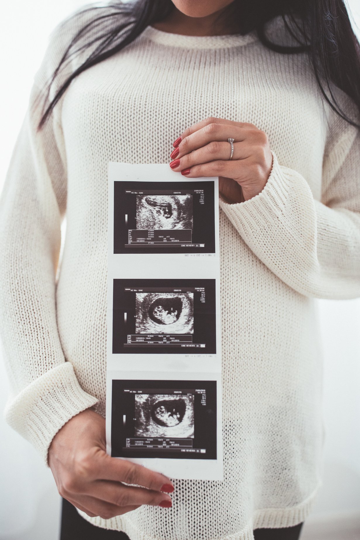 Pregnant lady holding ultrasound